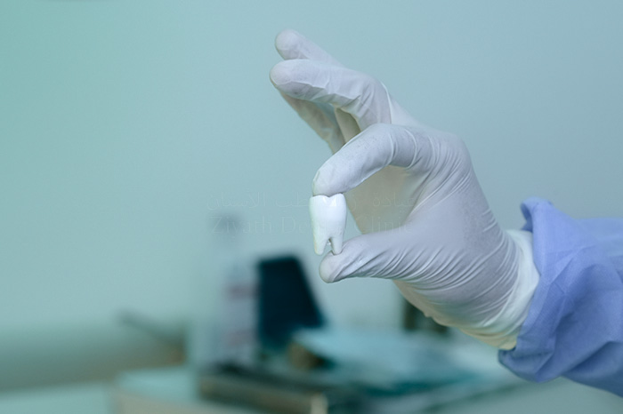 Painless tooth extraction and surgical wisdom tooth removal