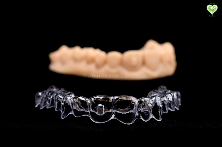 Orthodontic braces and alignment treatments for adults and adolescents
